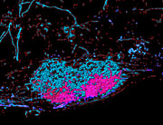 Gehirnstammkern, der Informationen von Interneuronen aus dem Rückenmark sammelt (blau); Informationen einer funktionellen Interneuronen-Subgruppe fliesst in einem Teilareal zusammen (pink).
