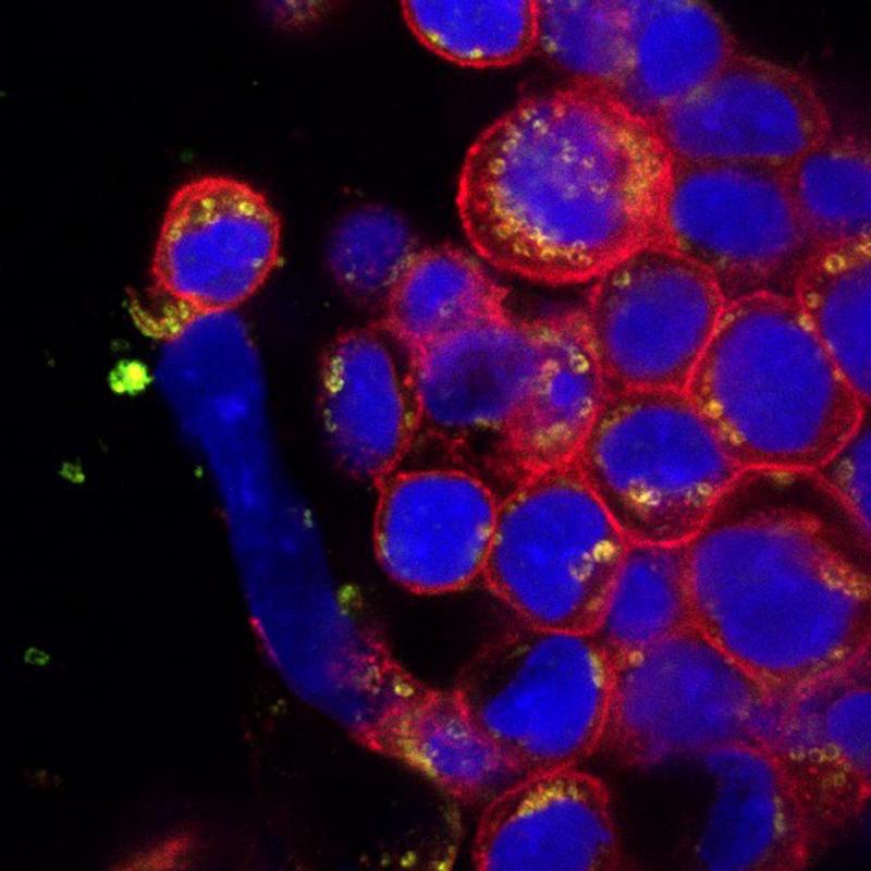 Mikroskopiebild einer Zellkultur. Blau markiert sind die Zellkerne, rot die Membranstrukturen und grün das zu lokalisierende Protein.