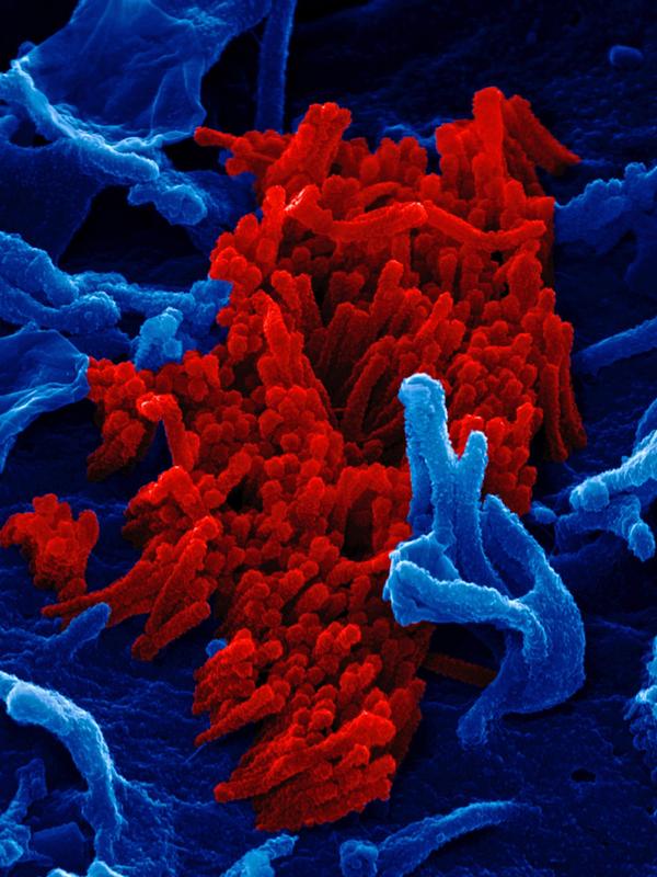 Wissenschaftler haben neue Wirtszellfaktoren identifiziert, die für Influenza-A-Infektionen unerlässlich sind. Das Bild zeigt Viren der Schweinegrippe (H1N1). 