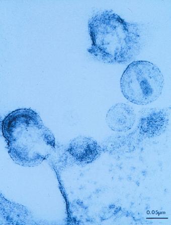 AIDS-Viren verlassen eine befallene Zelle des Immunsystems. 