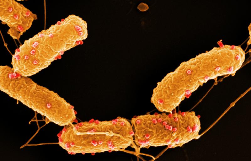 Adsorption of phage JWAlpha to Achromobacter DSM 11852 cells (Scanning electron micrograph) Sample was taken 5 min after pahge application. Adsorbed Phages are coloured in red. 