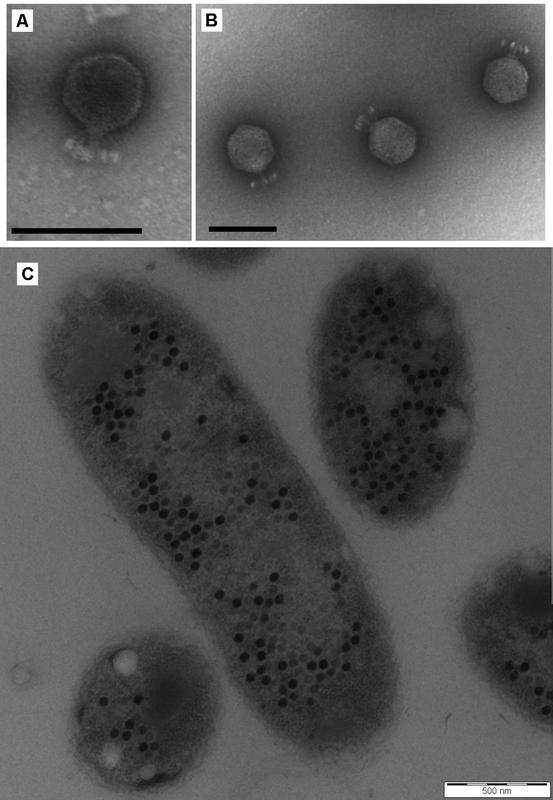 Bacteriophages are viruses that infect and replicates within bacteria (Achromobacter 90 min after infection with alpha phages)