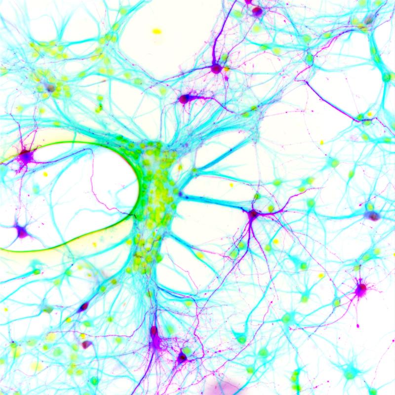 Nervenzellen, die den veränderten Glycinrezeptor herstellen, haben einen zusätzlichen Genabschnitt eingeschleust bekommen, der für ein Fluoreszenzprotein kodiert und sie aufleuchten lässt (lila). 