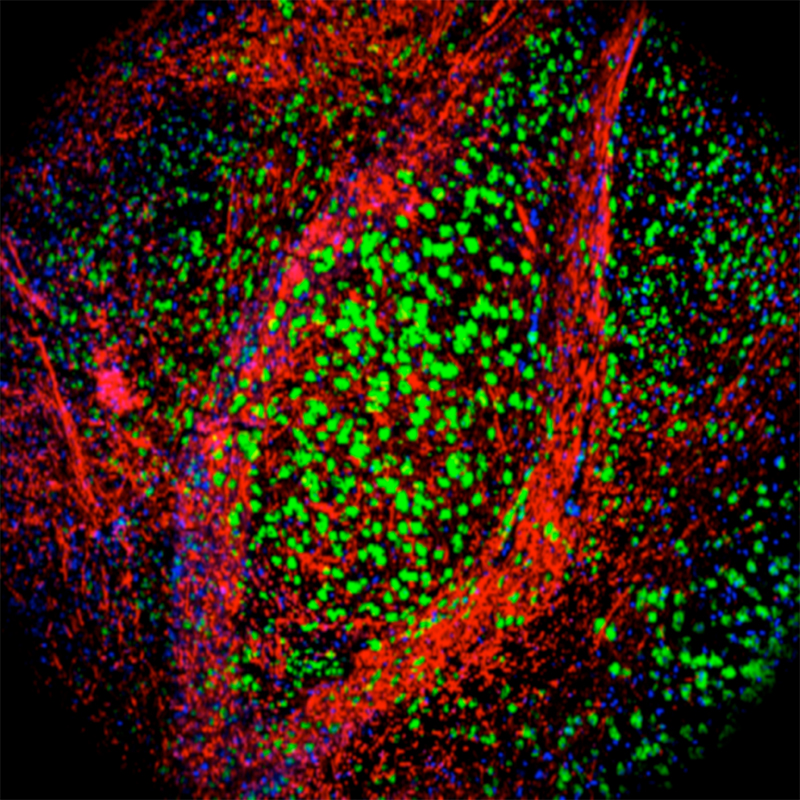 The absence of coronin 1 in neurons results in severe neurobehavioral defects. Coronin1 (green) in neurons within the amygdala of the brain. Red: neurofilament as neuronal marker; Blue: nuclear stain