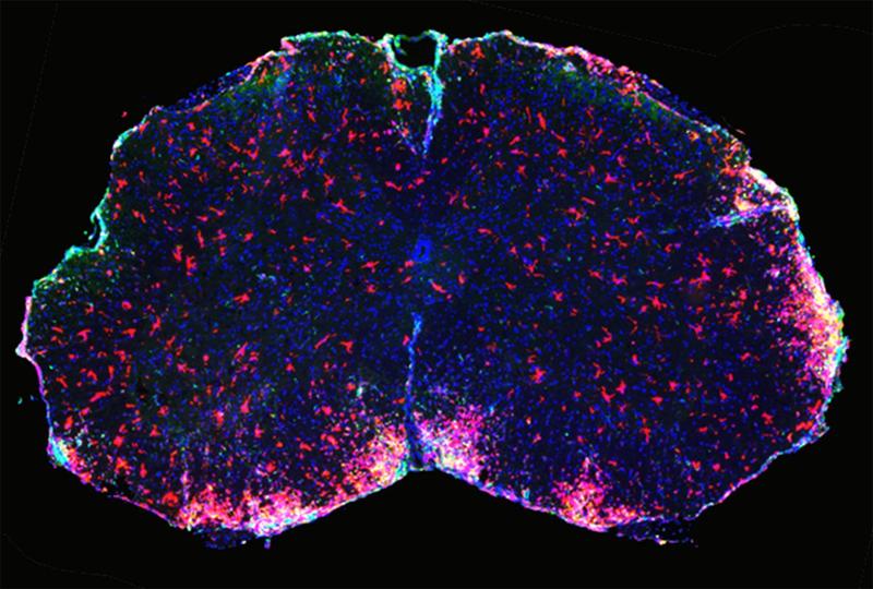 Ausschnitt des Rückenmarks von Mäusen unter dem Fluoreszenzmikroskop. DMF wirkt auf die hier rot markierten Immunzellen,