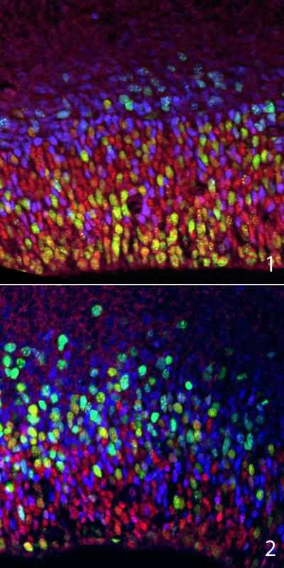 Mäuse, denen das Protein Trrap bei der Gehirnentwicklung fehlt (2), weisen im Vergleich zur Kontrollgruppe (1) eine verringerte Anzahl proliferierender neuronaler Vorläuferzellen (rot) im Gehirn auf.