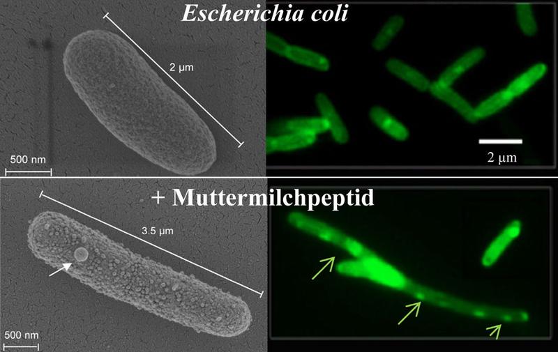 Elektronen- (l.) und Fluoreszenzmikroskopie (r.): Zellen des Bakteriums Escherichia coli ohne Einwirkung von Peptid (o.) und unter Einwirkung einer acylierten Variante von Lactoferricin (u.)