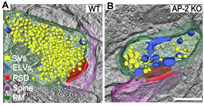 Elektronentomogramme und 3D-Rekonstruktionen präsynaptischer Nervenendigungen der somatosensorischen Großhirnrinde von Wildtyp- (A) und AP-2(μ)-Knockout-Mäusen (B). 