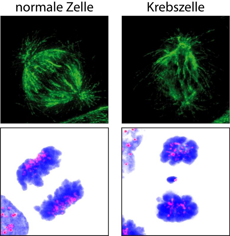 Normale Zelle: korrekte Ausbildung der Mikrotubuli des Spindelapparats und Gleichverteilung der Chromosomen (blau). Krebszelle: : ungeordnete Ausbildung der Mikrotubuli.
