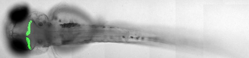 Spezifische Genaktivität nur in Purkinjezellen des Kleinhirns (Expression vom Grün fluoreszierenden Protein)