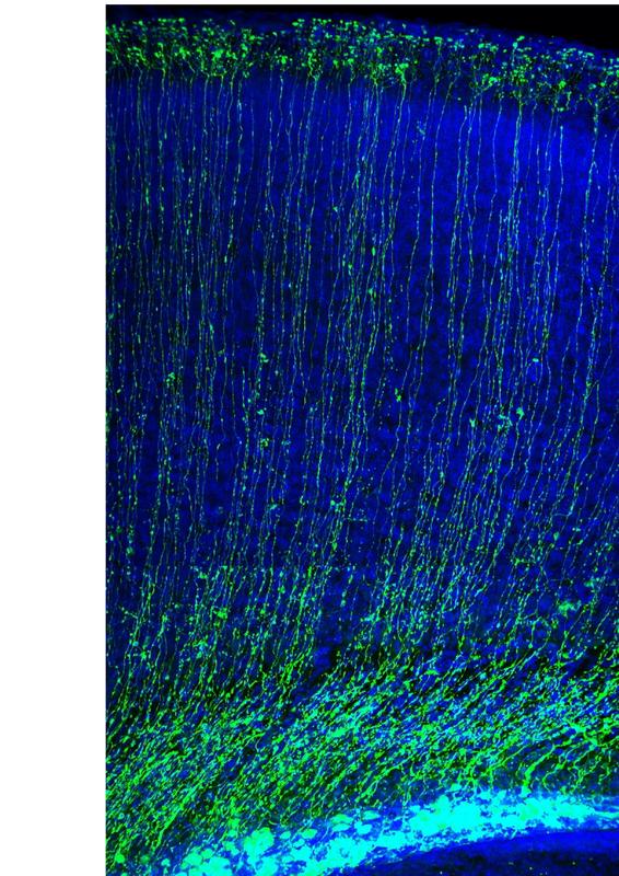 Radial glia cells in the postnatal forebrain