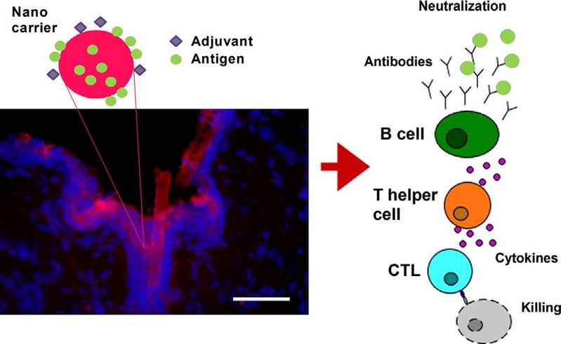 Mit Hilfe der Nanopartikel gelangen der Impfstoff (Antigen) und sein Verstärker (Adjuvant) ohne Einstich in die Haut. So lösen sie im Körper eine Immunantwort aus.