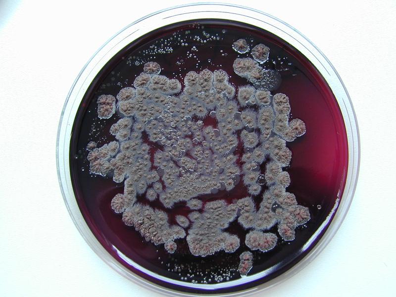 The collected soil and water samples were analyzed in the laboratory for their identity. 
