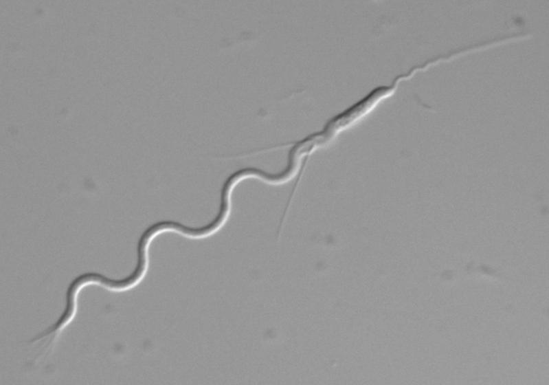 Spermien gibt es in den unterschiedlichsten Formen und Größen: Die Samenzelle des Plattwurms „Macrostomum lignano“ (Bild) besitzt einen Vorderfühler (rechts) und zwei seitliche Borsten. 