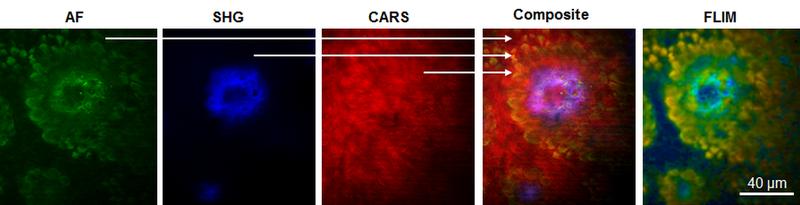 Laser-Tomograph der Firma JenLab macht minimale Hautveränderungen sichtbar, nicht nur in der Gewebearchitektur und chemischen Zusammensetzung, sondern auch über fluoreszierende Biomoleküle. 