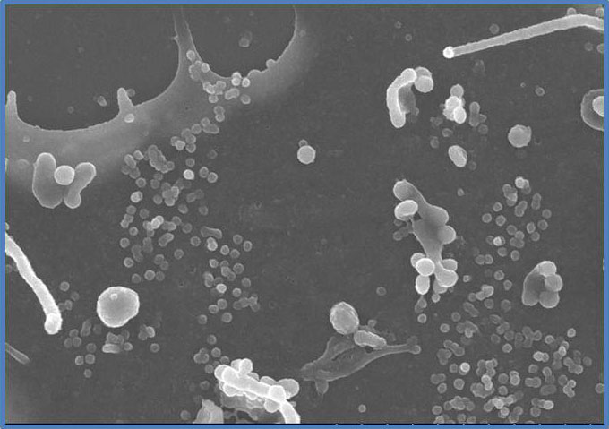 Transmissionselektronenmikroskopische Aufnahme: Zu sehen ist eine HI-Virus produzierende Zelle. Die  vesikulären, im Durchmesser 100 nm großen Strukturen sind neu gebildet