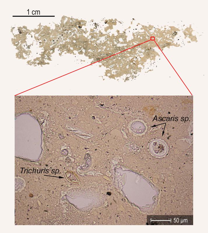 Exkrement vom Mensch oder Schwein mit Spulwurm (Ascaris sp.)- und Peitschenwurm (Trichuris sp.)-Befall.