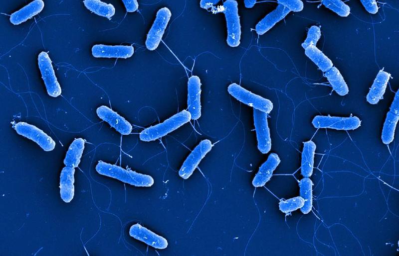 Rasterelektronenmikroskopische Aufnahme von Zellen des E. coli Typstamms DSM 30083T