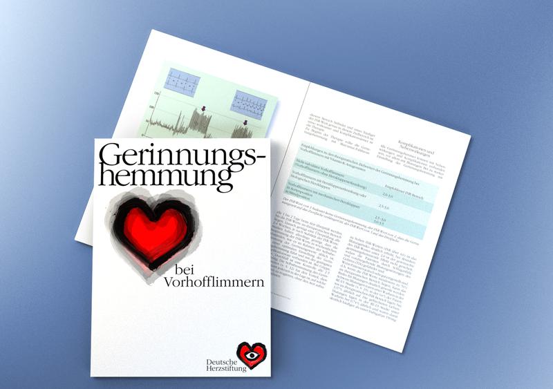 Experten-Ratgeber „Gerinnungshemmung bei Vorhofflimmern“