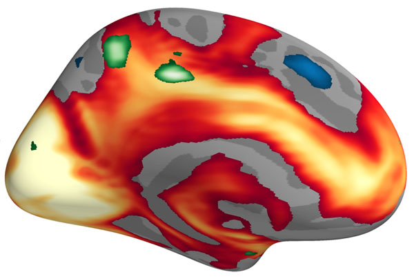 Brain activity: red and yellow indicates the more active areas of the brain when negative emotional images are rated as highly stimulating. Green indicates the areas that become more active in women