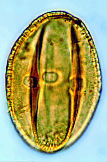 Pollenkorn aus dem Ölschiefer 