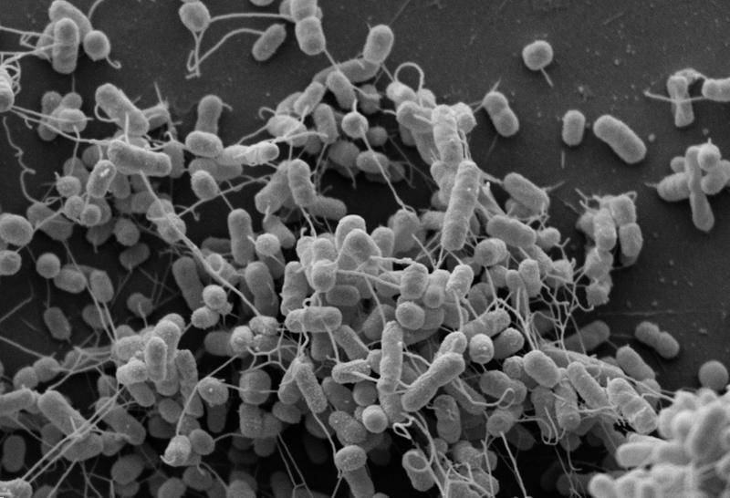 Elektronenmikroskopische Aufnahme gentechnisch veränderter Bakterienstämme der Arten Escherichia coli und Acinetobacter baylyi, die Aminosäuren über Nanokanäle austauschen. 