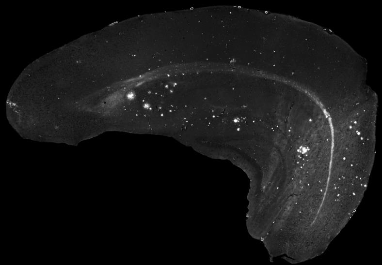 Im Fall der Alzheimer-Demenz entwickeln sich im Tiermodell altersabhängig Ablagerungen des Amyloid-Beta-Proteins im Gehirn. Diese können markiert und sichtbar gemacht we