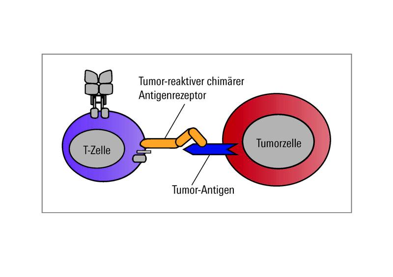 Mit einem synthetischen Antigenrezeptor ausgestattet, können T-Zellen an einem Oberflächenmolekül auf den Tumorzellen andocken und diese zerstören.