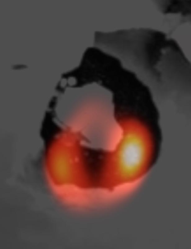 The LBT image of the Loki lava lake (orange) laid over a Voyager image of the same structure (dark shade). 
