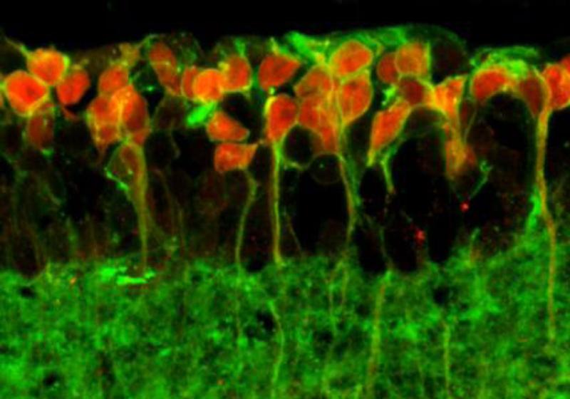 Längsschnitt durch die Netzhaut einer blinden Maus, die mit Opto-mGluR6 therapiert wurde. Die Opto-mGluR6-tragenden Zellen wurden mit einem Fluoreszenz-Farbstoff markiert und leuchten daher rot.