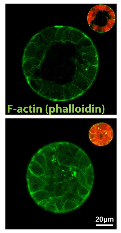 Ohne Gerüst kein Zusammenhalt: Schaltet man das Protein Formin-like 2 aus, so bilden die betroffenen Epithelzellen (unten) keine Hohlräume, anders als unbehandelte Zellen (oben). 