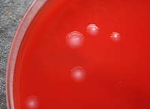 "Small Colony Variants" in einer Kulturschale 