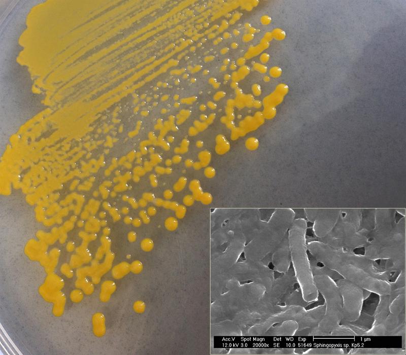 Bakterienkolonien der entdeckten Bakterienart Sphingopyxis fribergensis auf einem glukosehaltigen Kulturmedium und rasterelektronenmikroskopische Nahaufnahme der Bakterienzellen