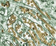 Elektronenmikroskopische Aufnahme von H5N1 (Virus ist digital golden nachgefärbt), Quelle: Wikipedia