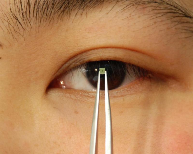 Solche winzigen, von Ulmer Ingenieuren entwickelten Chips stecken unter anderem in Retina-Implantaten und Neuromodulatoren 