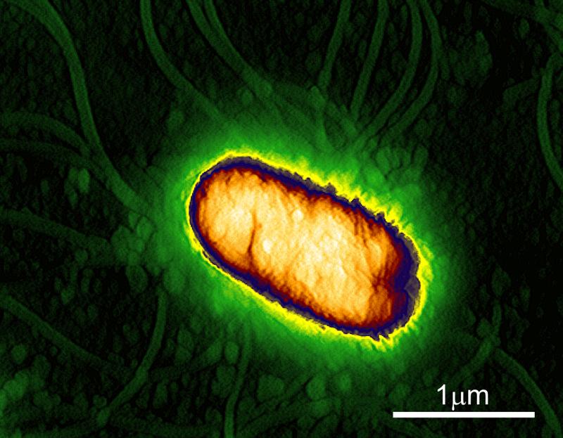 In der Zellhülle von Bakterien sorgen Transportermoleküle für die Aufnahme von Nährstoffen. Der Funktionsmechanismus wurde jetzt entschlüsselt. Die Aufnahme zeigt ein Escherichia coli Bakterium.