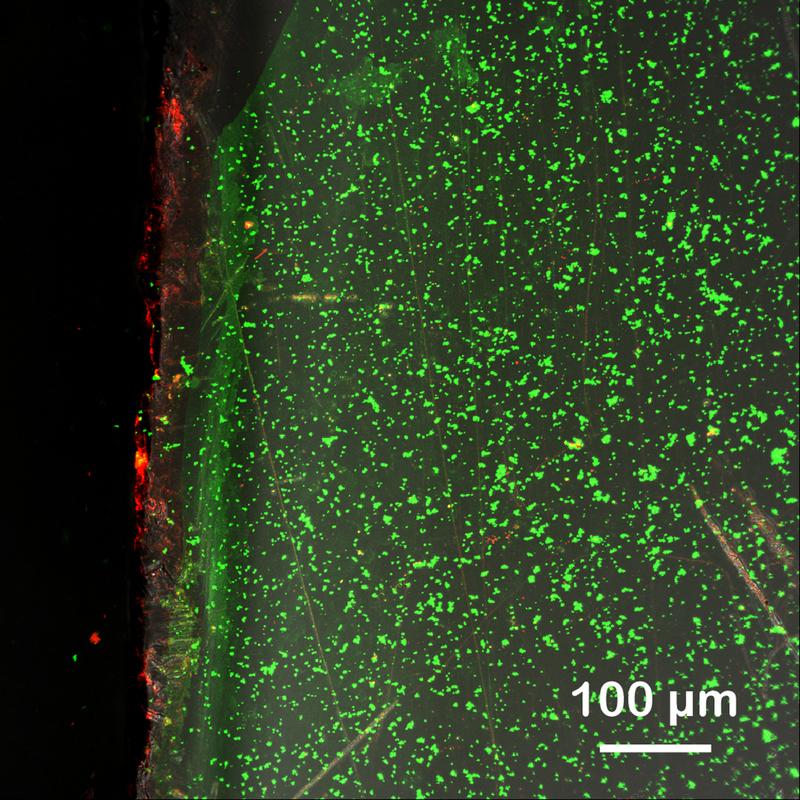 Biofilm auf einem Aufwuchsträger aus Acrylglas 24 h nach Einbringung in den Biogasreaktor (37°C). Rot: Gesamtheit aller Bacteria/Archaea, grün: Extrazelluläre, polymere Substanzen: die Matrix.
