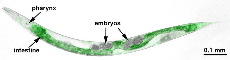 Microscopy picture of C. elegans