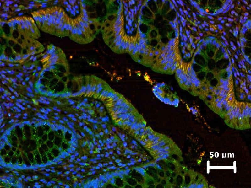 Erkrankungen, wie beispielsweise Darmkrebs, werden häufig durch entzündliche Prozesse initiiert. Fluoreszenzmikroskopische Aufnahme von entzündetem Darmgewebe. Zellkerne sind blau eingefärbt. 