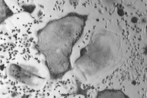Osteoklasten (große Strukturen) geben Cathepsin K ab und warten mithilfe dieses Proteins den Knochen.