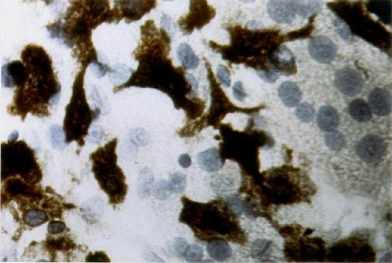 Hepatozyten und Lebermakrophagen (Kupferzellen - braun gefärbt) sollen in der Kulturschale vermehrt werden Foto: Scharf et.al. UKG