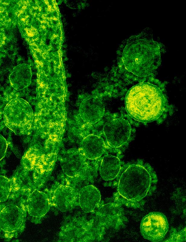 Transmissionselektronenmikroskopische Aufnahme (TEM) von MERS-CoV-Viruspartikeln außerhalb der Zelle (Virionen)