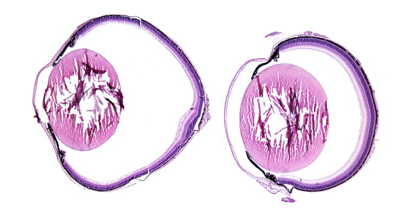 The eyeball becomes extended from loss of LRP2 receptor proteins (left) in comparison to an eye with intact LRP2 receptor protein (right); histological mouse sections.