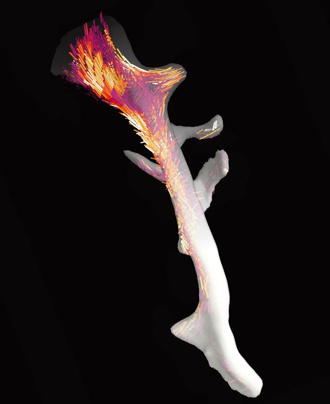 The bone and its nanostructure: Thanks to their newly developed algorithm, researchers at PSI succeeded in mapping the order and alignment of the tiny collagen fibrils.