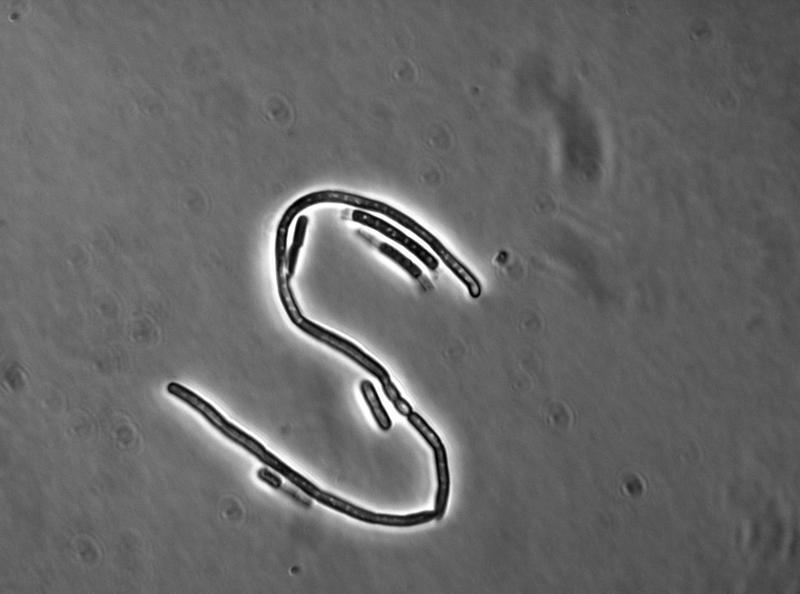 Lichtmikroskopische Aufnahme von B. cereus in einem small colony variant. 