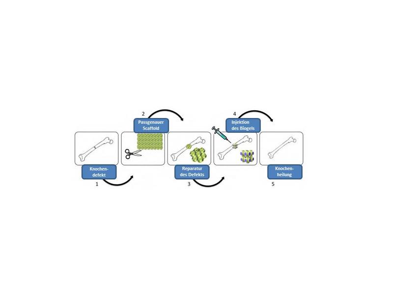 Prinzip der Entwicklung von Knochenersatzmaterialien im EU-Projekt InnovaBone