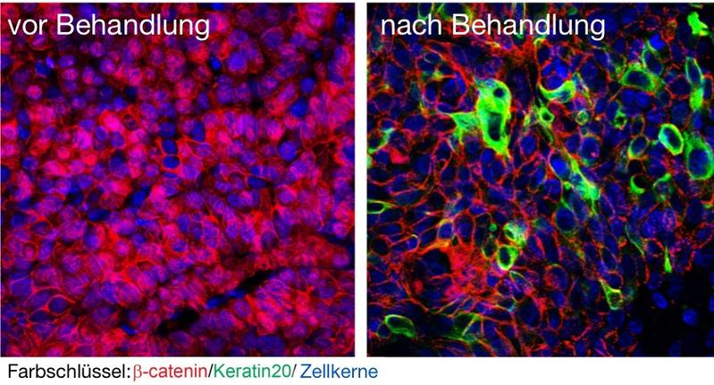 Im Bild links ist Beta-Catenin (rot) zu sehen, was auf Krebsstammzellen hinweist. Rechts wurde Beta-Catenin entfernt.