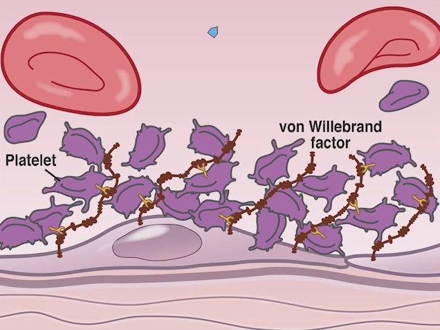 Schematic presentation of platelets (purple) which stick to the over-long Von Willebrand factor (brown).