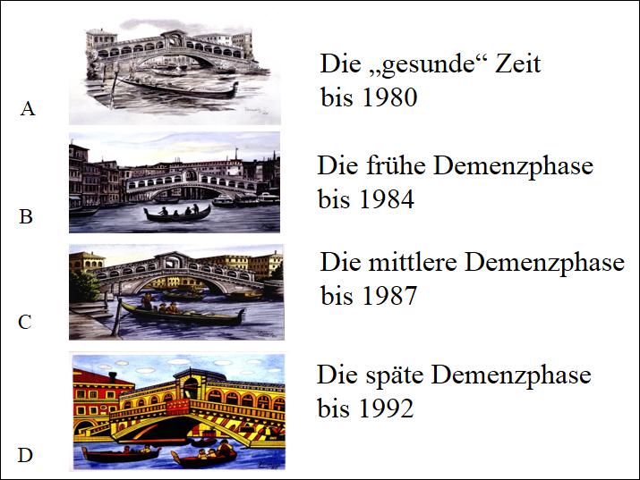 Darstellungen der Rialto-Brücke vom Graphiker und Designer Carolus Horn in verschiedenen Stadien seiner Alzheimer-Krankheit