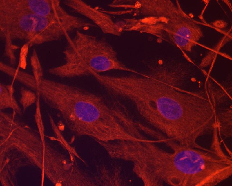 Seit mehr als 30 Jahren werden Patienten in Heidelberg mit Stammzellen aus dem eigenen Blut behandelt.